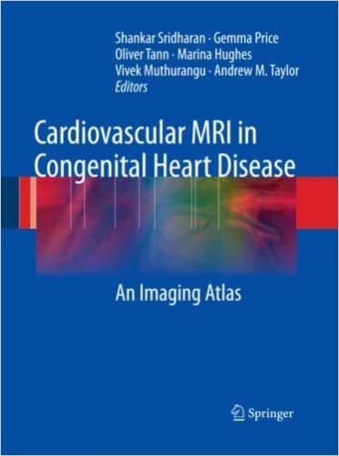 Cardiovascular Mri In Congenital Heart Disease An Imaging Atlas 4849