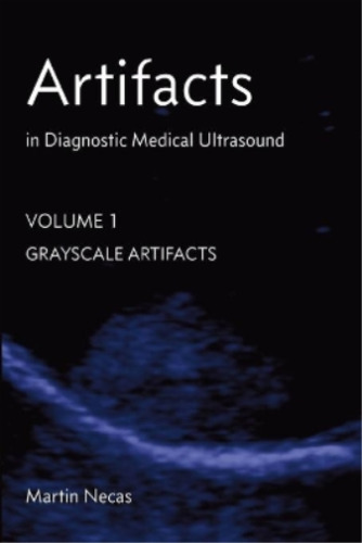 Martin Necas - Artifacts In Diagnostic Medical Ultrasound: Grayscale Artifacts